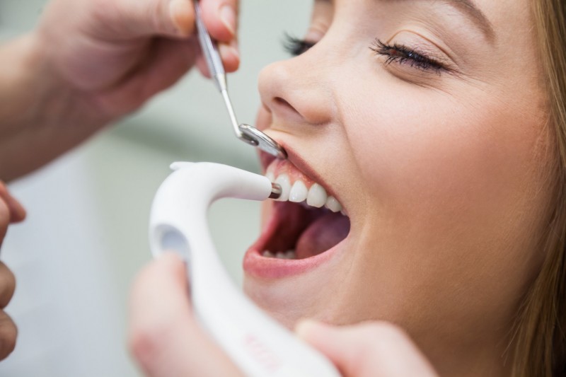 Чистка зубов в стоматологическом кабинете